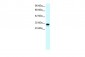 SSBP2 antibody - N-terminal region